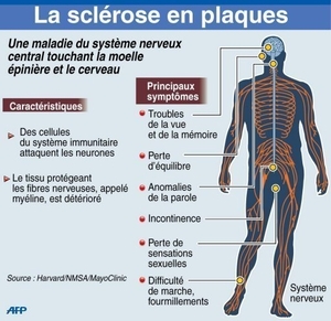 CBD et sclérose en plaque